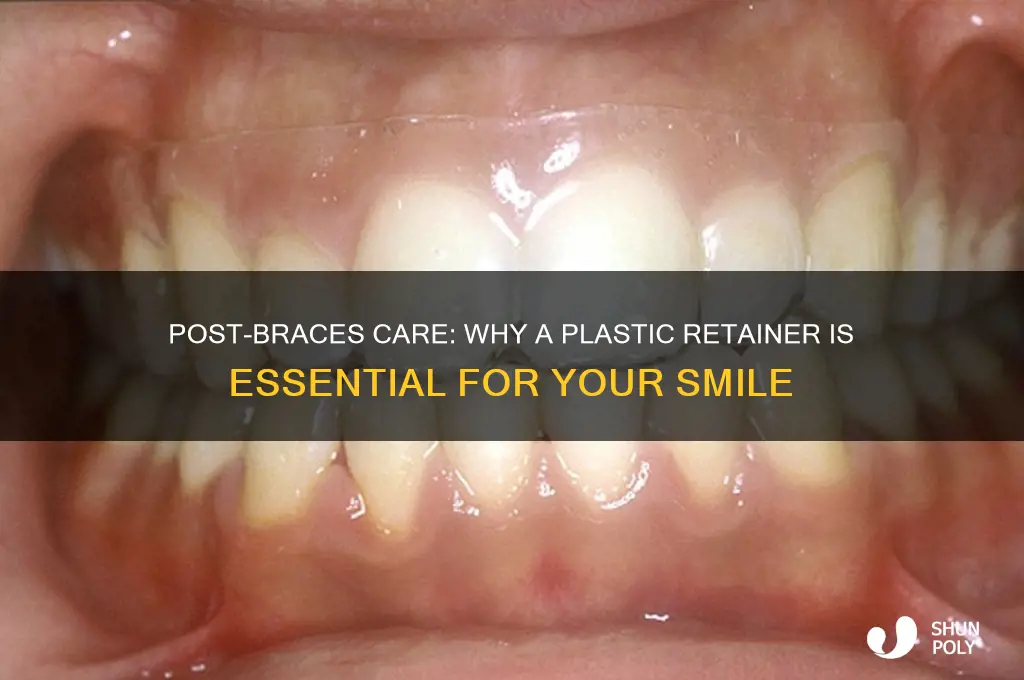 when you get your braces off plastic brace