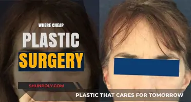 Affordable Plastic Surgery Destinations: Where to Find Quality at Lower Costs