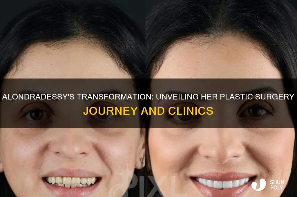where did alondradessy get plastic surgery