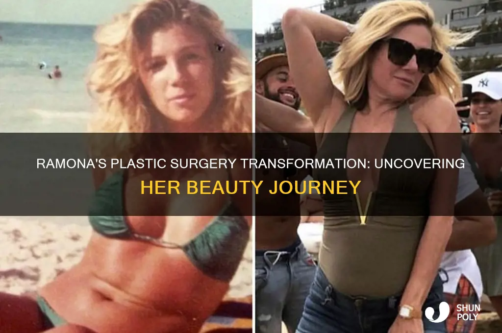 where did ramona get her plastic sergery