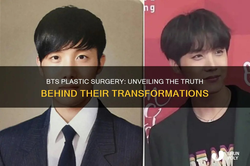 where does bts get plastic surgery