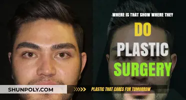 Unveiling the Show: Where Extreme Makeovers Meet Plastic Surgery