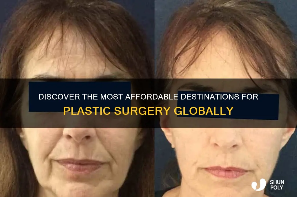 where is the most affordable to get plastic surgery