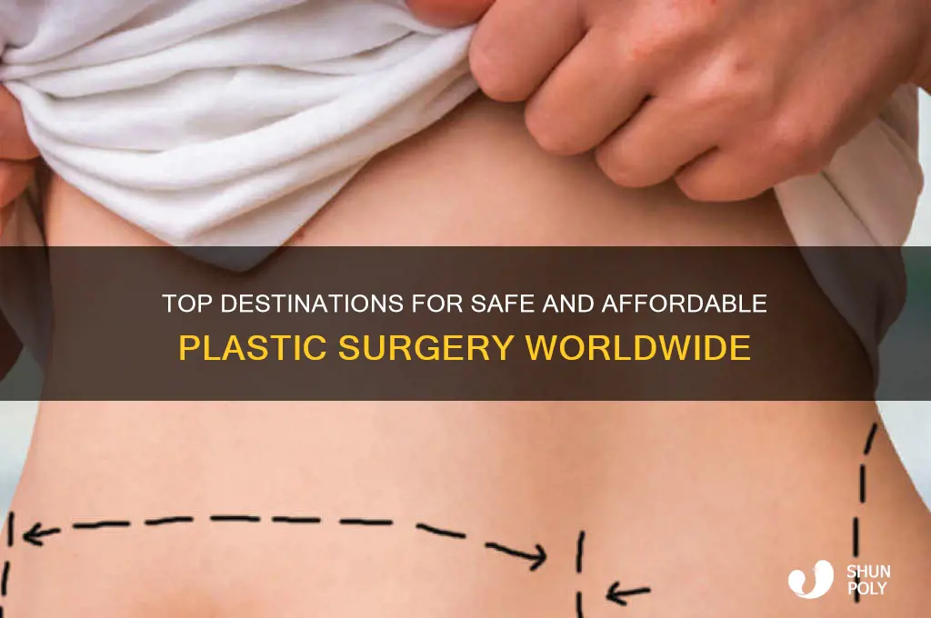 where to get plastic surgery