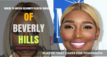 Where to Stream Celebrity Plastic Surgeons of Beverly Hills Online