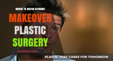 Top Platforms to Stream Extreme Makeover Plastic Surgery Episodes