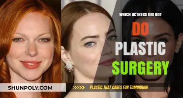 Natural Beauty: Actresses Who Embrace Their Authentic Look Without Surgery