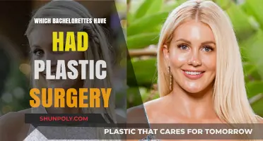 Bachelorette Beauty Transformations: Plastic Surgery Confessions and Revelations