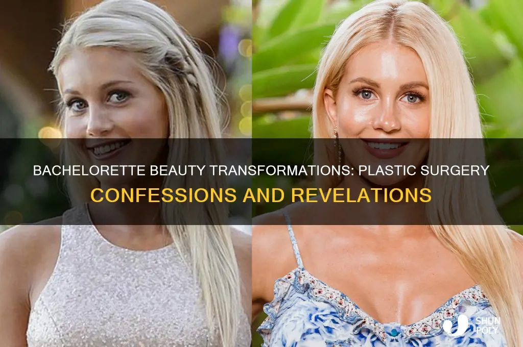 which bachelorettes have had plastic surgery