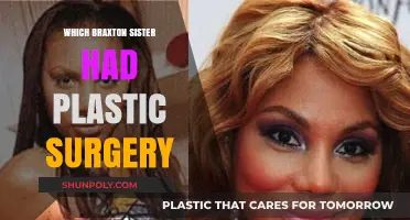 Braxton Sisters Plastic Surgery: Which Star Transformed Her Look?