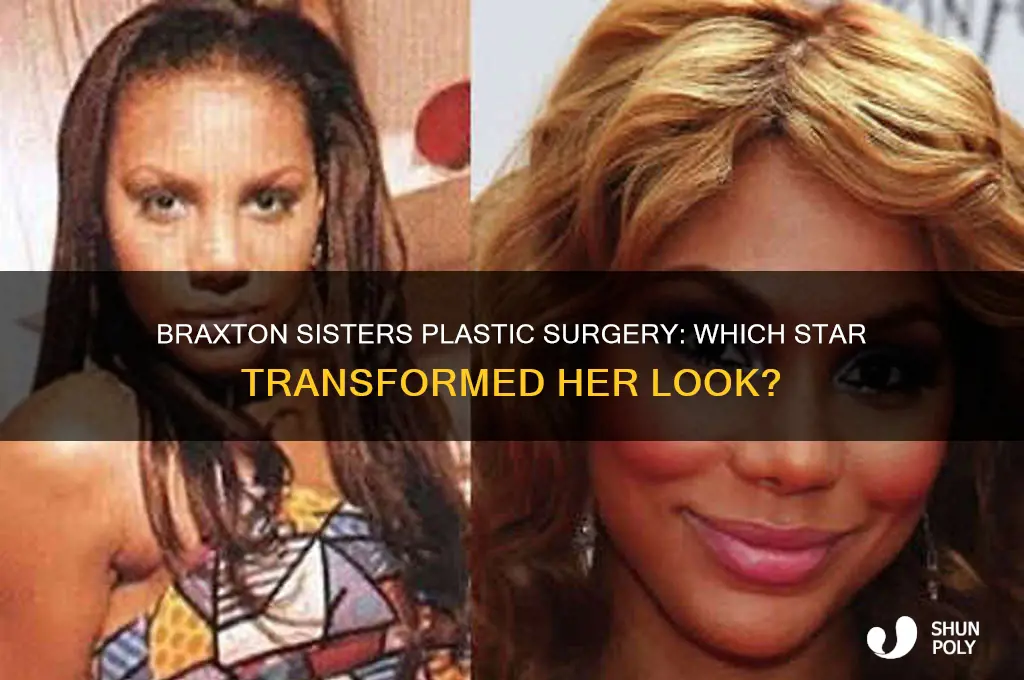which braxton sister had plastic surgery