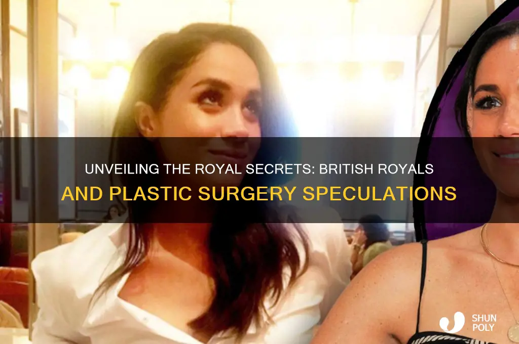 which british royal have had plastic surgery