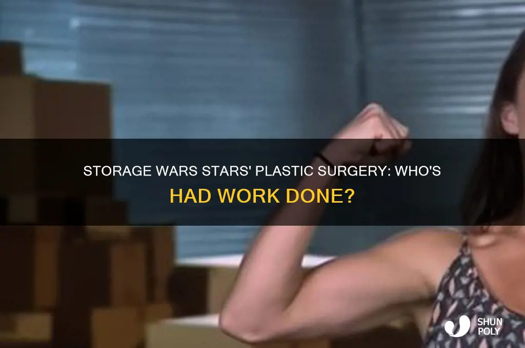 which cast member of storage wars plastic surgery