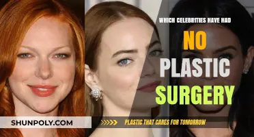 Celebrities Embracing Natural Beauty: Stars Who Skipped Plastic Surgery