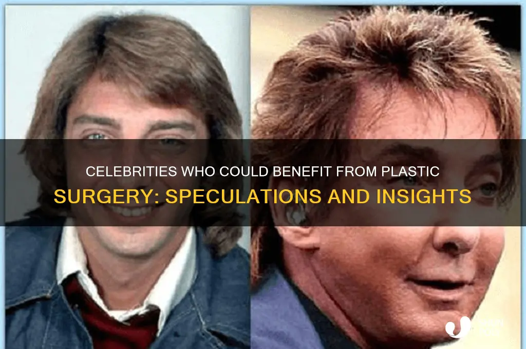 which celebrity could use plastic surgery