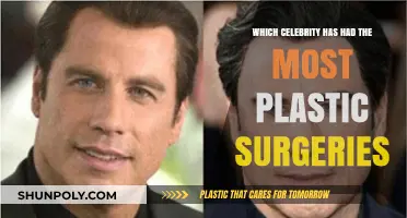Unveiling the Celebrity with the Most Plastic Surgeries: Who Tops the List?