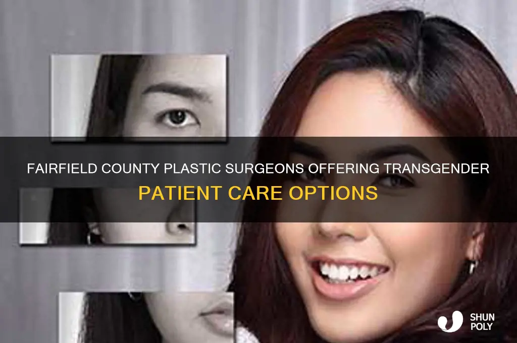 which fairfield county plastic surgeons treat transgender paitients