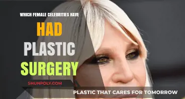 Female Celebrities and Their Plastic Surgery Transformations Revealed