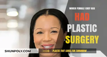 Female Chefs and Plastic Surgery: Who’s Gone Under the Knife?