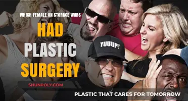 Storage Wars Female Stars: Plastic Surgery Speculations and Revelations