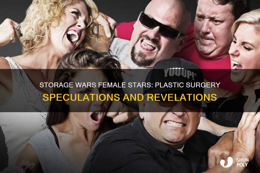 which female on storage wars had plastic surgery