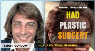 Hollywood's Plastic Surgery Secrets: Stars Who've Gone Under the Knife