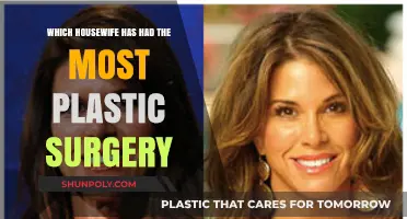 Most Transformed Housewives: Who's Had the Most Plastic Surgery?