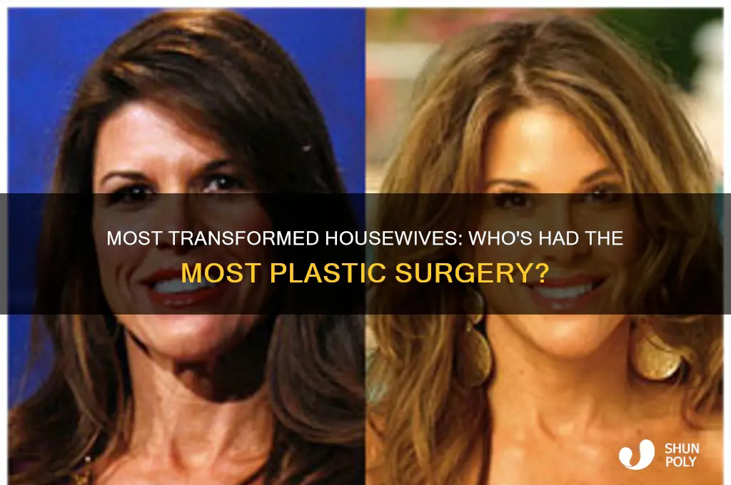 which housewife has had the most plastic surgery