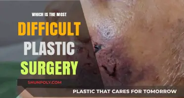 Unveiling the Most Challenging Plastic Surgery Procedures: Expert Insights