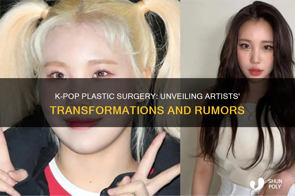 which kpop artist used plastic surgery