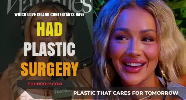 Love Island Stars Who've Gone Under the Knife: Plastic Surgery Revelations