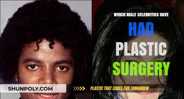 Unveiling the Truth: Male Celebrities Who've Had Plastic Surgery