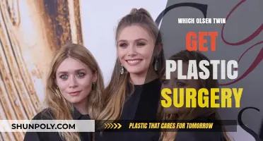 Olsen Twins Plastic Surgery: Unraveling the Truth Behind the Rumors