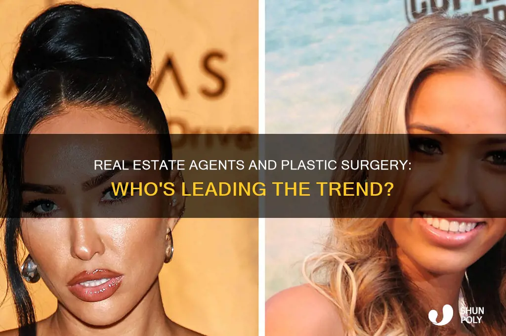 which people have most plastic surgery real estate agents