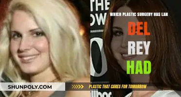 Lana Del Rey's Plastic Surgery: Unveiling Her Transformation Journey