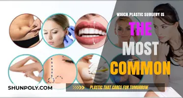 Most Popular Plastic Surgery Procedures: Trends and Insights Revealed