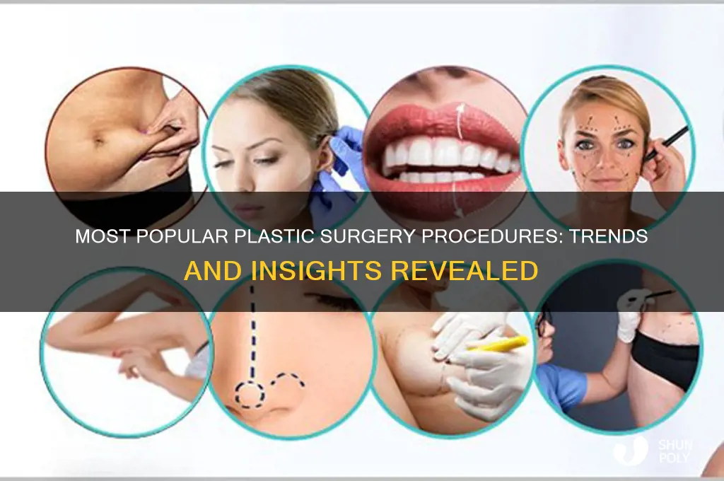 which plastic surgery is the most common