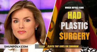 Royal Transformations: Unveiling Plastic Surgery Secrets of the Monarchy