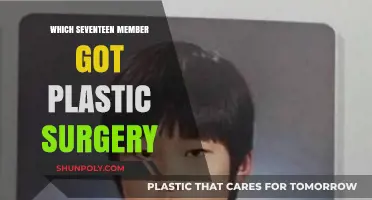 Seventeen Members Plastic Surgery: Who Got Work Done?