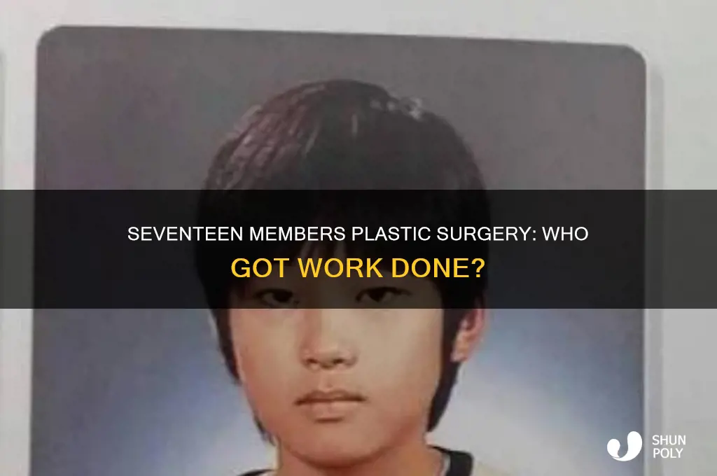 which seventeen member got plastic surgery