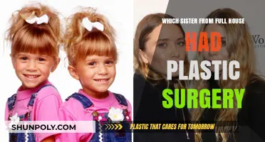 Full House Sisters: Plastic Surgery Speculations and Transformations Revealed