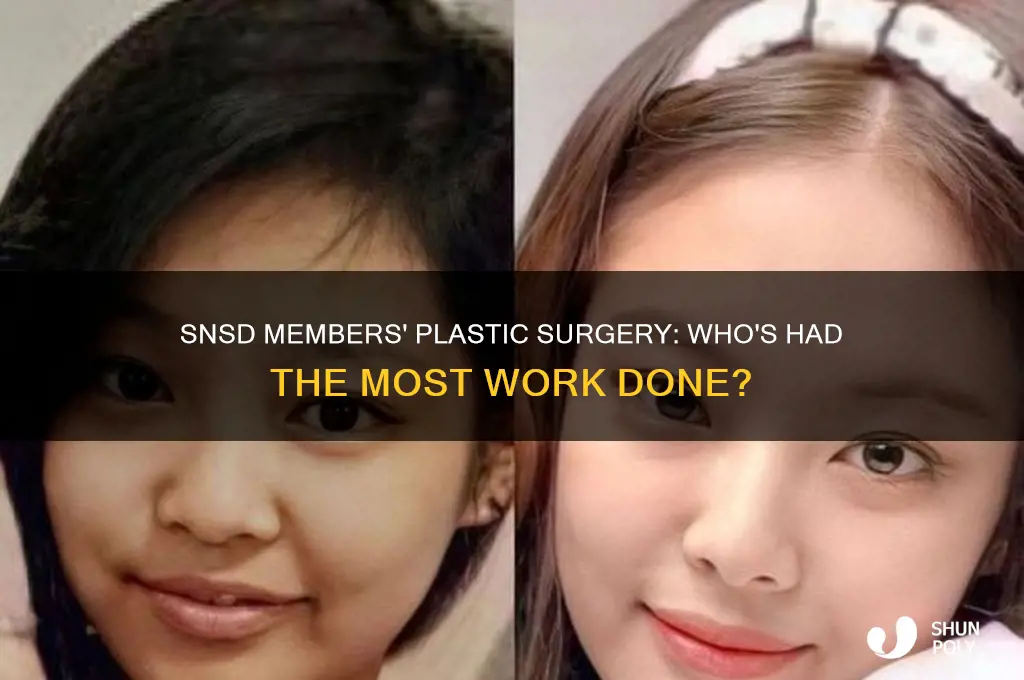 which snsd member has the most plastic surgery