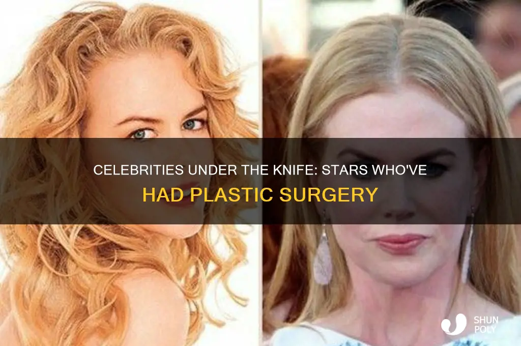 which stars have had plastic surgery