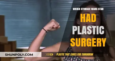 Storage Wars Stars' Plastic Surgery: Who Went Under the Knife?