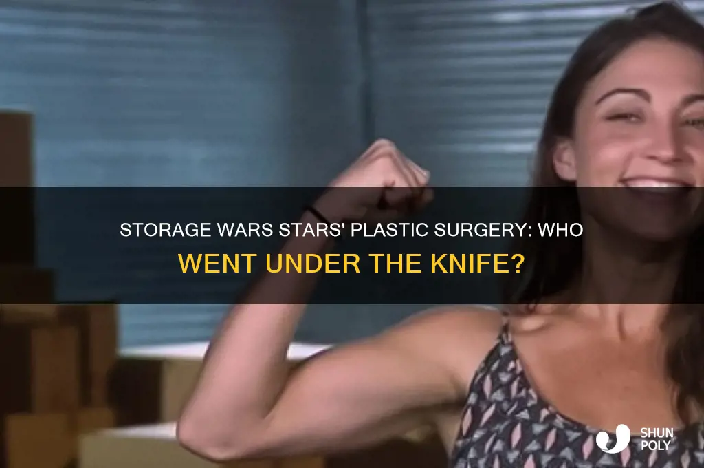 which storage wars star had plastic surgery