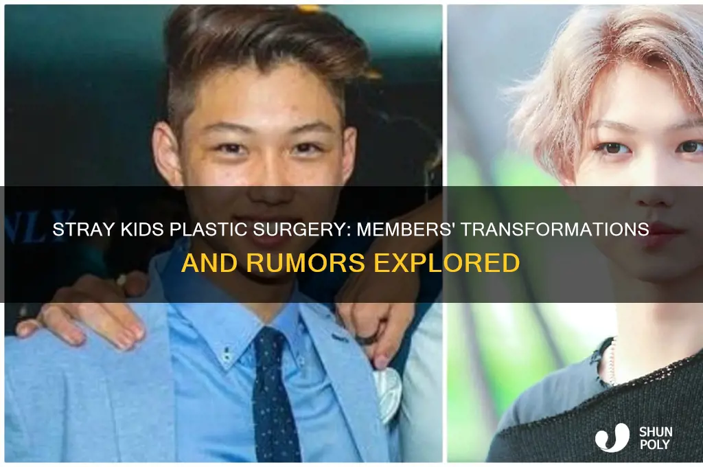 which stray kids members had plastic surgery