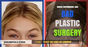 Supermodel Plastic Surgery Gone Wrong: Shocking Transformations Revealed