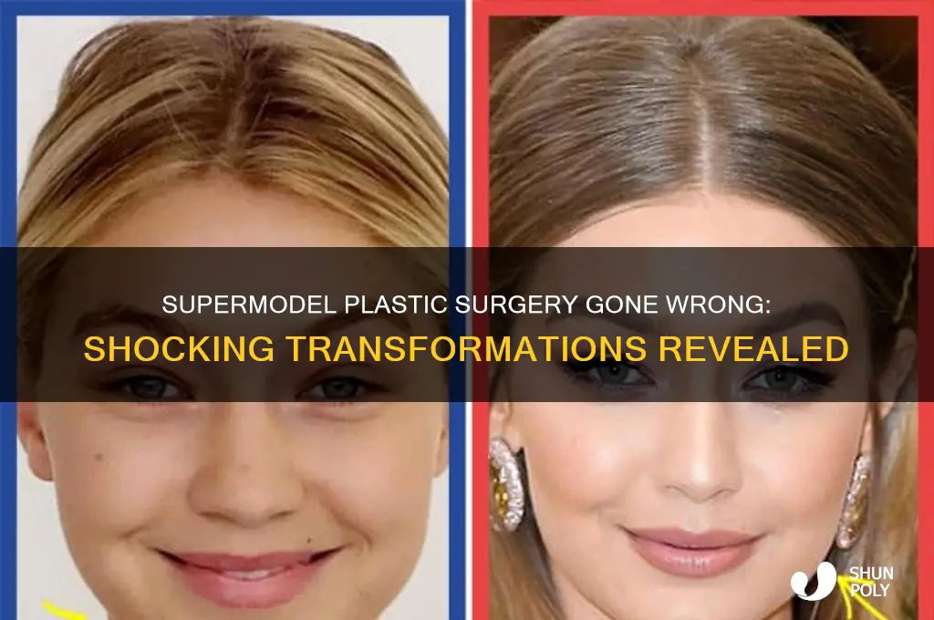 which supermodel had bad plastic surgery