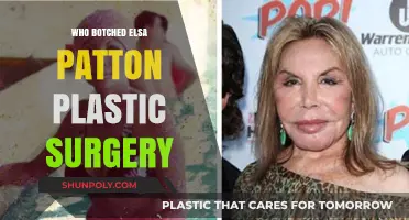 Elsa Patton's Plastic Surgery: Who Botched the Reality Star's Look?