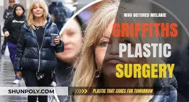 Melanie Griffith's Plastic Surgery: Uncovering the Botched Procedure and Aftermath